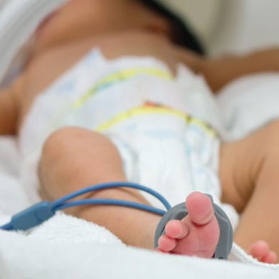 Матични клетки кај предвремено родени бебиња